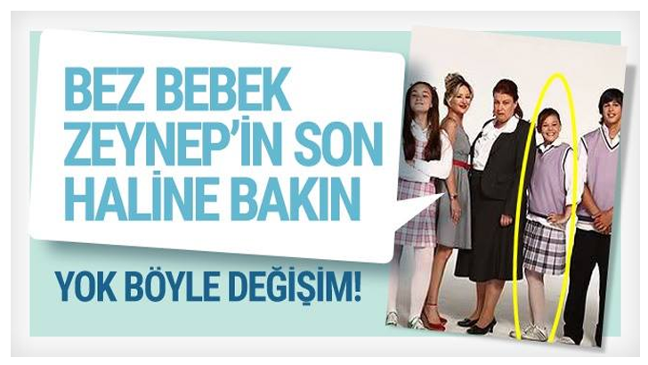 Bez Bebek Zeynep’in Son Haline Bakın Yok Böyle Değişim