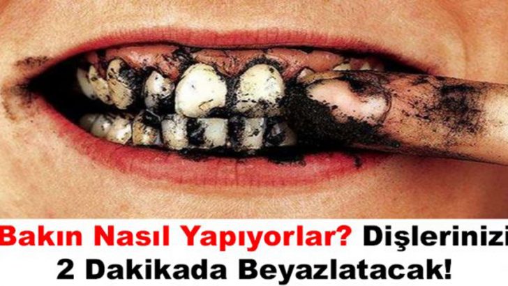 Dişleri 2 Dakikada Beyazlatıyor… Yanlış Duymadınız! Çok Basit Yöntem… Bakın Nasıl Yapıyorlar?