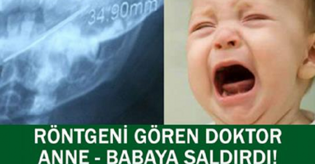 Röntgeni Gören Doktor Şok Oldu ve Anne - Babaya Saldırdı