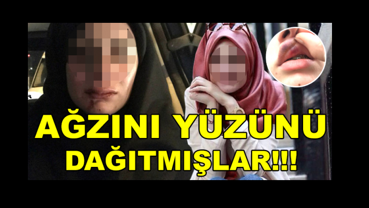 SOSYAL MEDYA FENOMENİ SALDIRIYA UĞRADI! HERKES ŞOKTA…