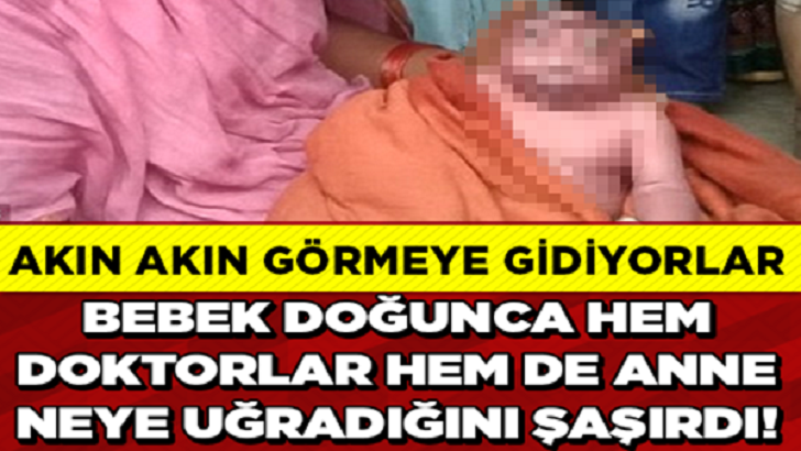 ANNESİ EMZİRMEYE ÇEKİNİYOR, HERKES AKIN AKIN BEBEĞİ GÖRMEYE GİDİYOR!