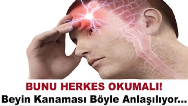 BEYİN KANAMASI BÖYLE ANLAŞILIYOR..!