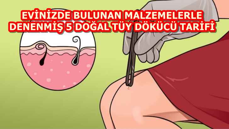 EVİNİZDE BULUNAN MALZEMELERLE DENENMİŞ 5 DOĞAL TÜY DÖKÜCÜ TARİFİ