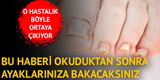 AYAKLARINIZIN SAĞLIĞINIZ HAKKINDA NELER SÖYLEDİĞİNE BAKIN...