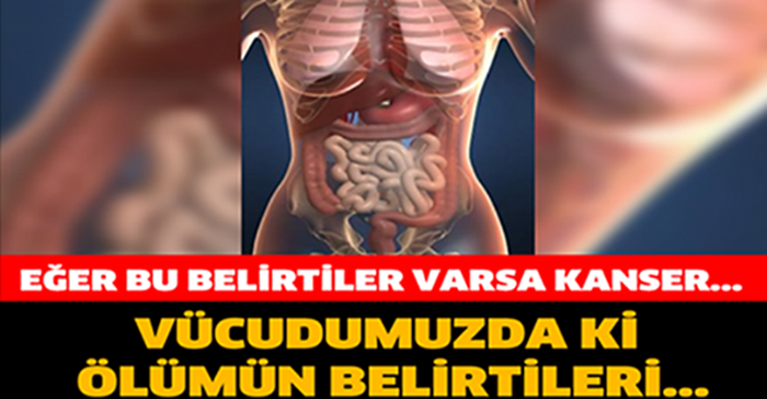 BU BELİRTİLER VARSA ŞAKAYA GELMEZ. İŞTE VÜCUDUMUZDAKİ Ö-LÜM BELİRTİLERİ