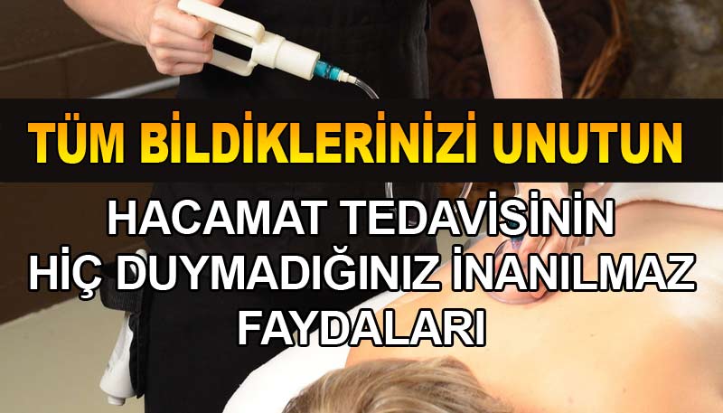 HACAMATIN BİLMEDİĞİMİZ İNANILMAZ FAYDALARI