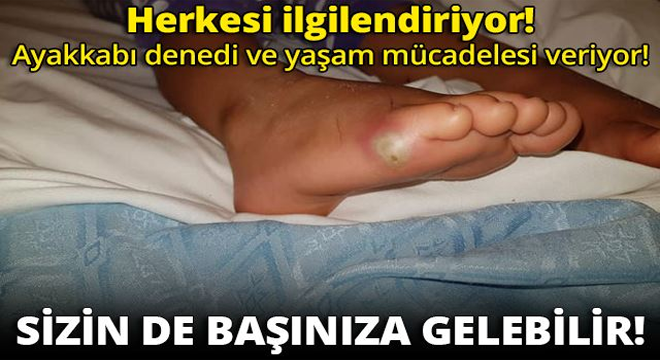 Herkesi ilgilendiriyor! Ayakkabı denedi ve yaşam mücadelesi veriyor!