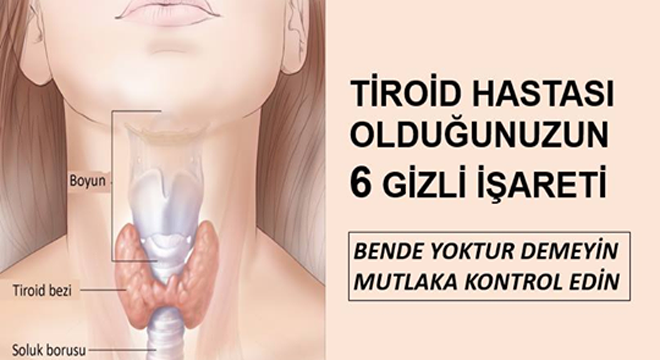 Tiroid Hastası Olduğunuzun 6 Gizli İşareti Bende Yoktur Demeyin