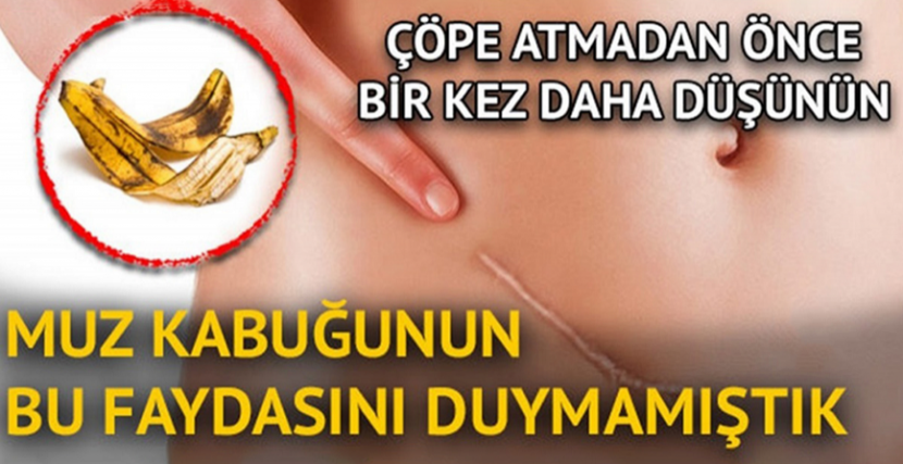 Muz Kabuğunu Sakın Çöpe Atmayın, Kullanım Alanları Saymakla Bitmiyor