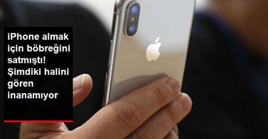 7 Yıl Önce iPhone Alabilmek Böbreğini Satan Gencin Hayatı Altüst Oldu