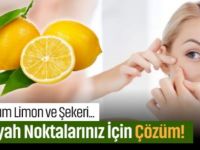 Siyah Noktalarınız İçin Çözüm! Limon ve Şeker Karışımı!