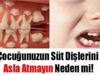 Çocuğunuzun Süt Dişlerini ASLA Atmayın! NEDEN Mİ?