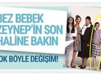 Bez Bebek Zeynep’in Son Haline Bakın Yok Böyle Değişim