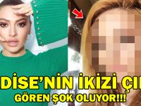 Hadise’nin İkizi Çıktı! Gören Şok Oluyor…