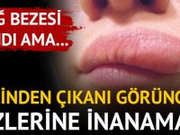 YAĞ BEZESİ SANDI, İÇİNDEN ÇIKANI GÖRÜNCE GÖZLERİNE İNANAMADI...