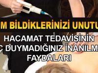 HACAMATIN BİLMEDİĞİMİZ İNANILMAZ FAYDALARI