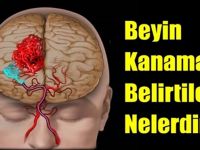 Beyin k-anaması geçirdiğinizi bu basit yöntemle hemen anlayabilirsiniz…