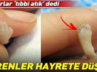 Doktorlar “Tıbbi Atık” Dedi, Görenler Hayrete Düştü